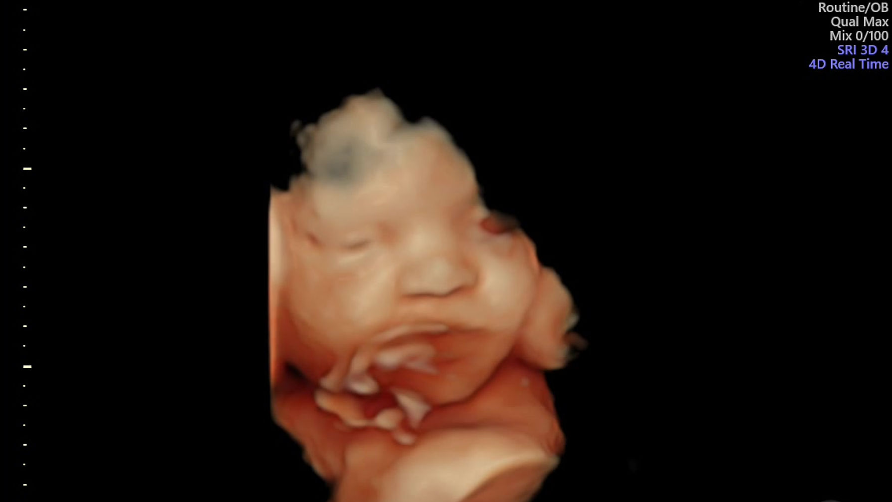 Oh Baby 4D Ultrasound